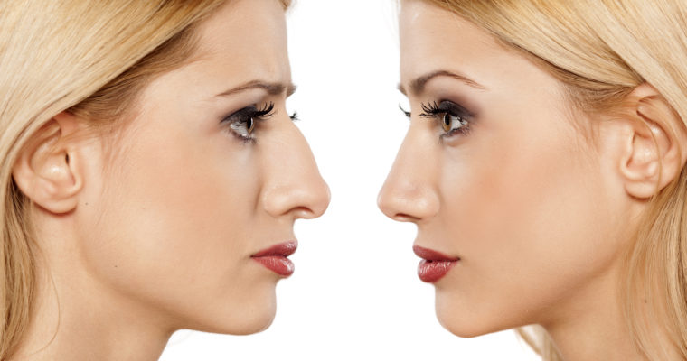 How to Take Care of Yourself During Rhinoplasty Recovery