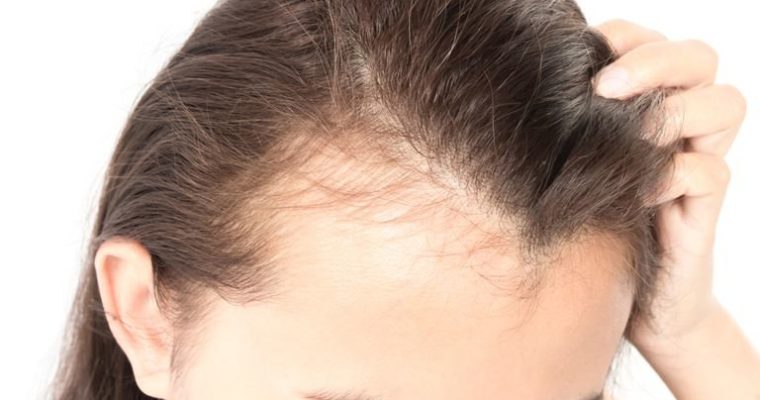 Singapore Dermatologist Explains 5 Top Causes Of Hair Loss