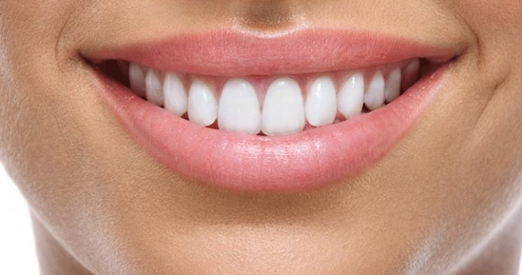 How to Achieve the Perfect Smile