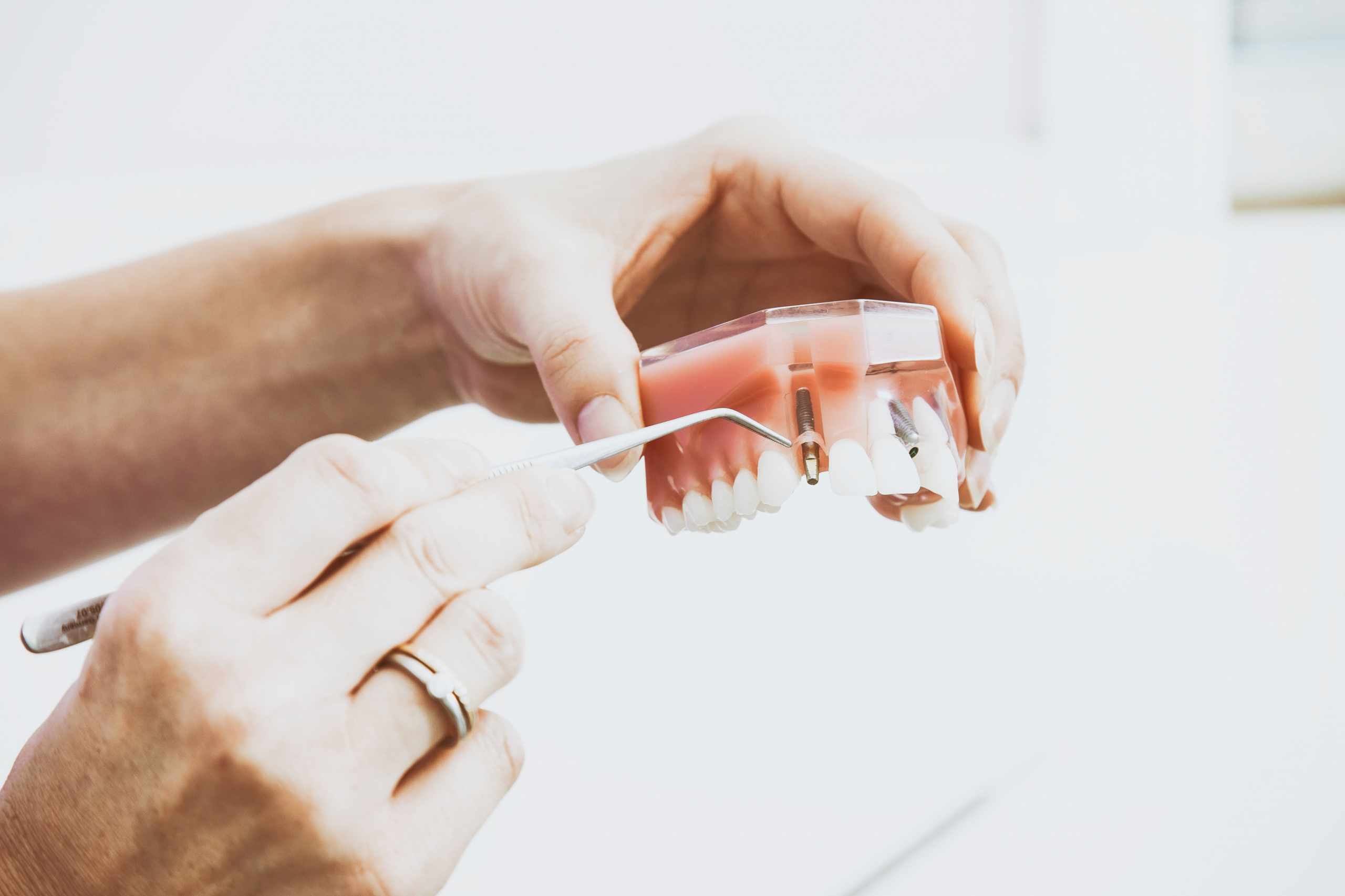 How To Effectively Care For Your Teeth In 5 Easy Steps