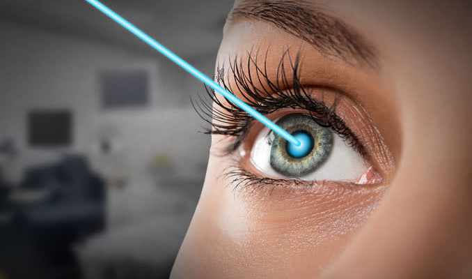 5 Questions to Ask Before Undergoing Lasik Treatment