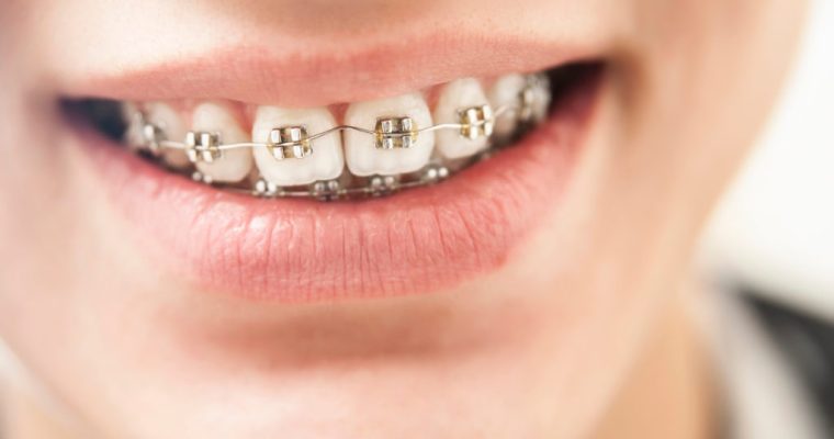 How Orthodontics Can Improve the Appearance of Your Teeth