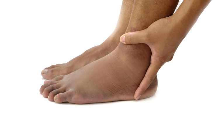 Symptoms of Poor Leg Circulation and Treatment Options