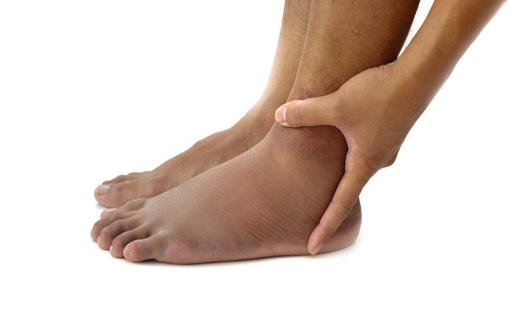 Symptoms of Poor Leg Circulation and Treatment Options