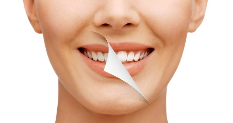 Cosmetic Dentistry Procedures That Can Beautify Your Smile
