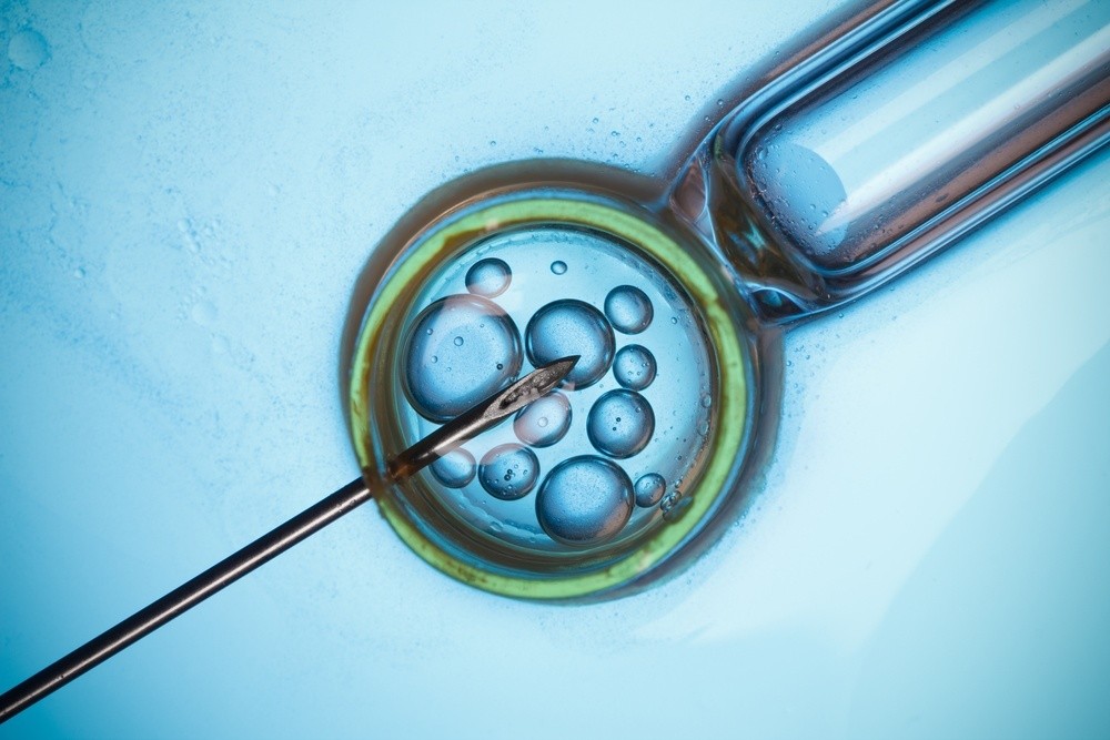 Quick and Handy Facts About IVF You Need to Know