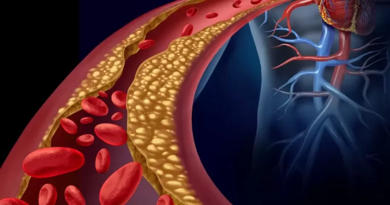 Complications From High Cholesterol Levels
