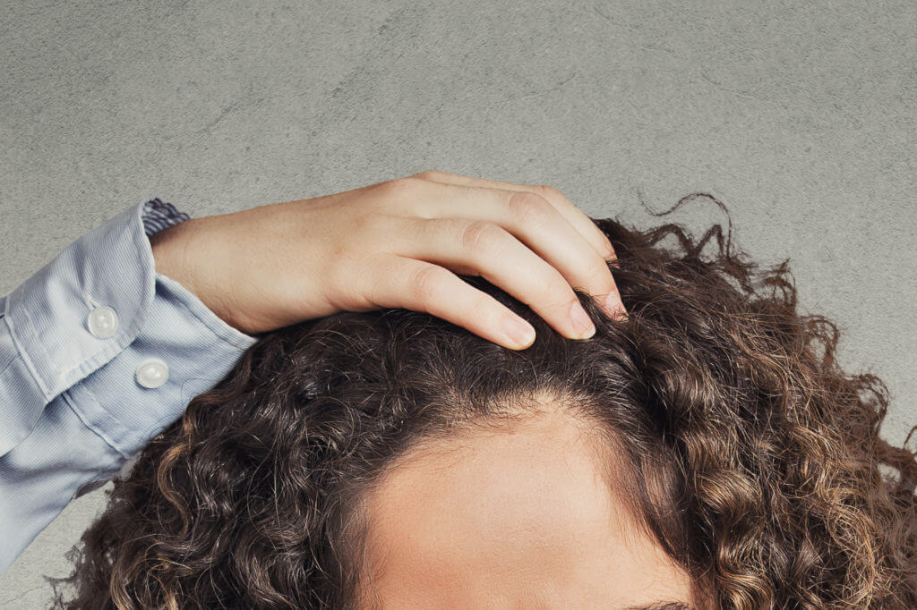 4 Common Hair Loss Risk Factors