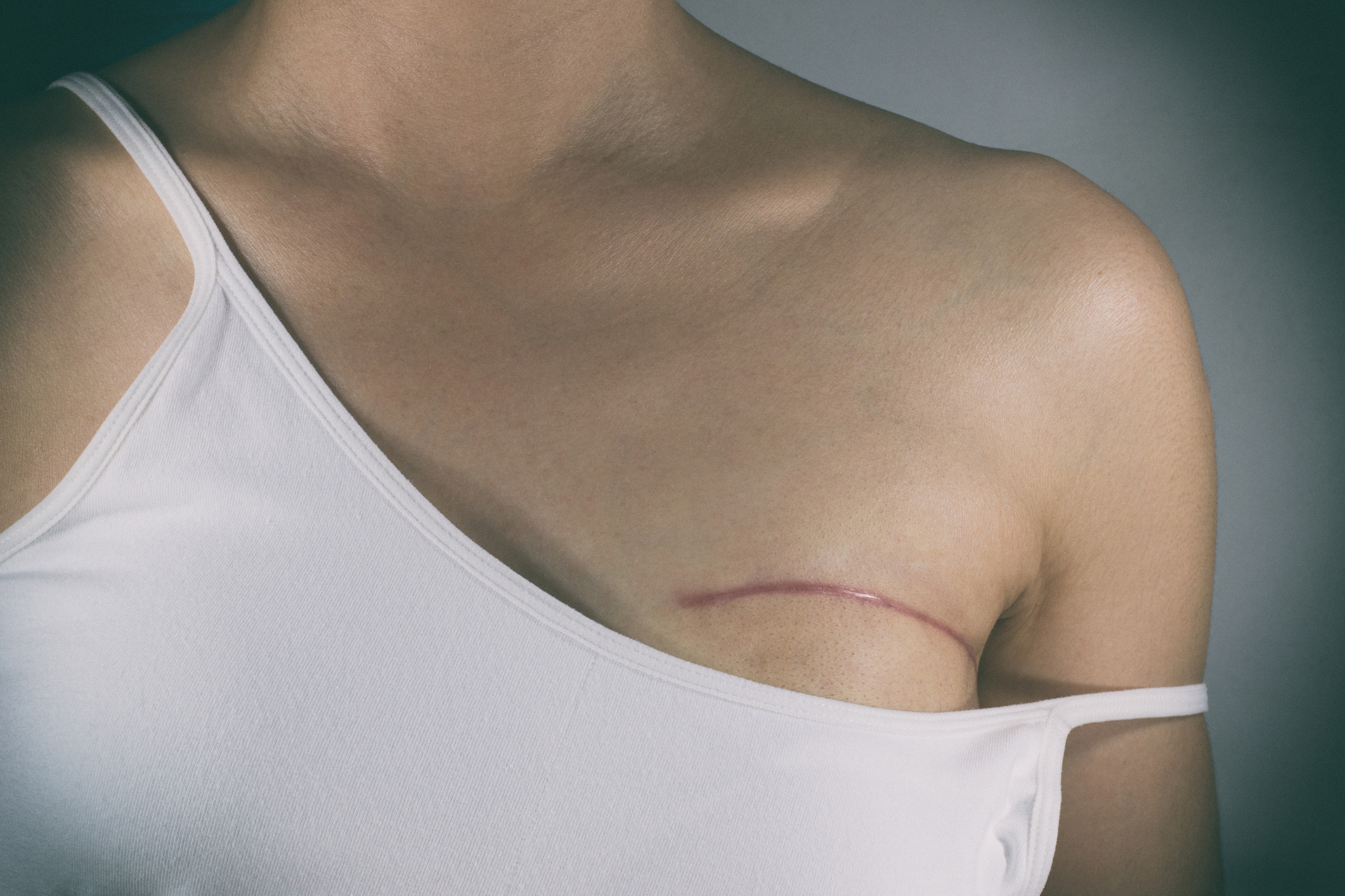 What You Need To Know About Breast Reconstruction Surgery