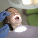 Teeth Gap Making