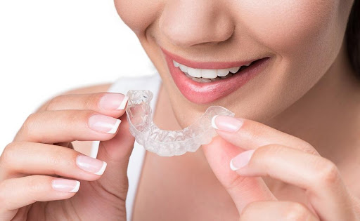 Invisible Aligners: A Game-Changer in Orthodontic Treatment